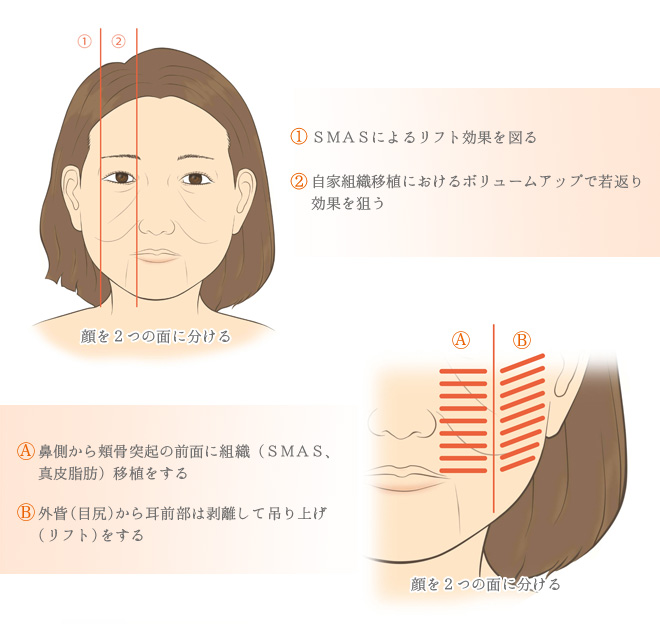 顔のしわとり