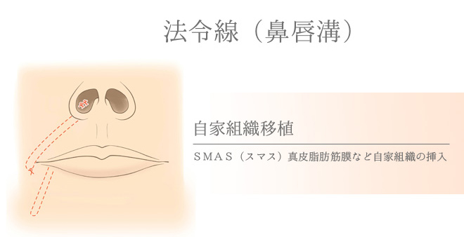 顔のしわとり